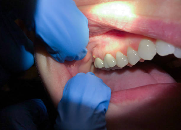 Best Broken Tooth Emergency  in Lexington, KY