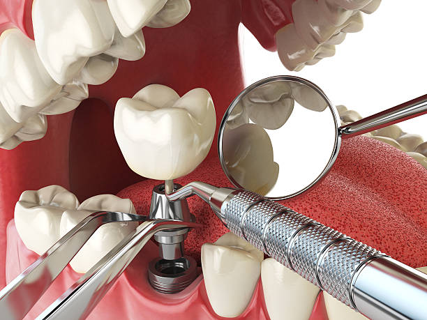 Emergency Gum Pain Relief in KY