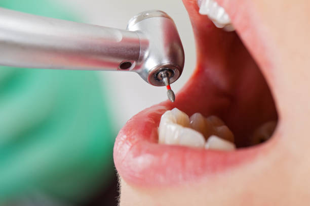 Best Root Canal Emergency Dentist  in Lexington, KY